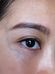 A close-up shot of a person's eye area, focusing on their eyebrow and the skin around the eye. There is a noticeable, faint vein running from the eyebrow towards the cheek. The skin texture appears smooth with natural lighting highlighting the features.