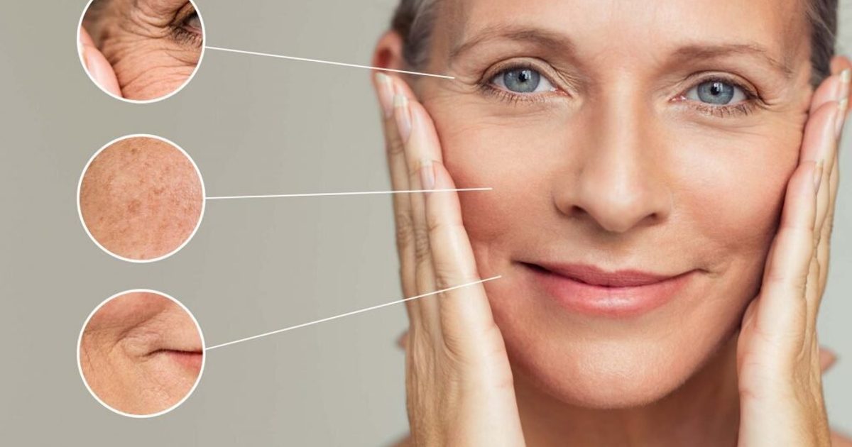 blog-1-1 Face and Body Wrinkles