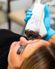 Halo Laser Treatment on patient at Lazaderm