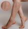 Close-up view of varicose veins on a person's legs, showing enlarged, swollen, and twisted veins typically appearing blue or dark purple.